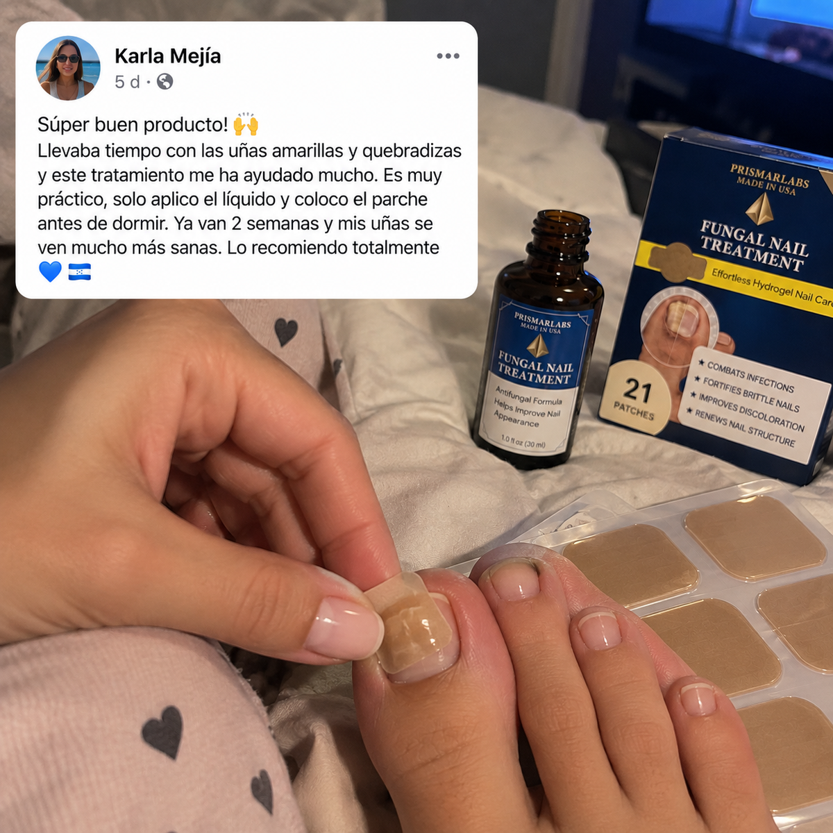 TRATAMIENTO HONGO FUNGAL NAIL — Parches de Hidrogel para Uñas