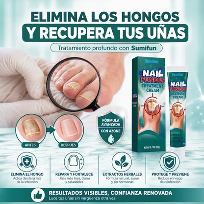 KIT RECUPERACIÓN TOTAL™  Sistema Profesional 2 en 1 para Uñas Dañadas y con Hongos Onicomicos GARANTÍA Y CERTIFICACIÓN MEDICA INCLUIDA