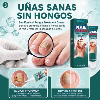 KIT RECUPERACIÓN TOTAL™  Sistema Profesional 2 en 1 para Uñas Dañadas y con Hongos Onicomicos GARANTÍA Y CERTIFICACIÓN MEDICA INCLUIDA