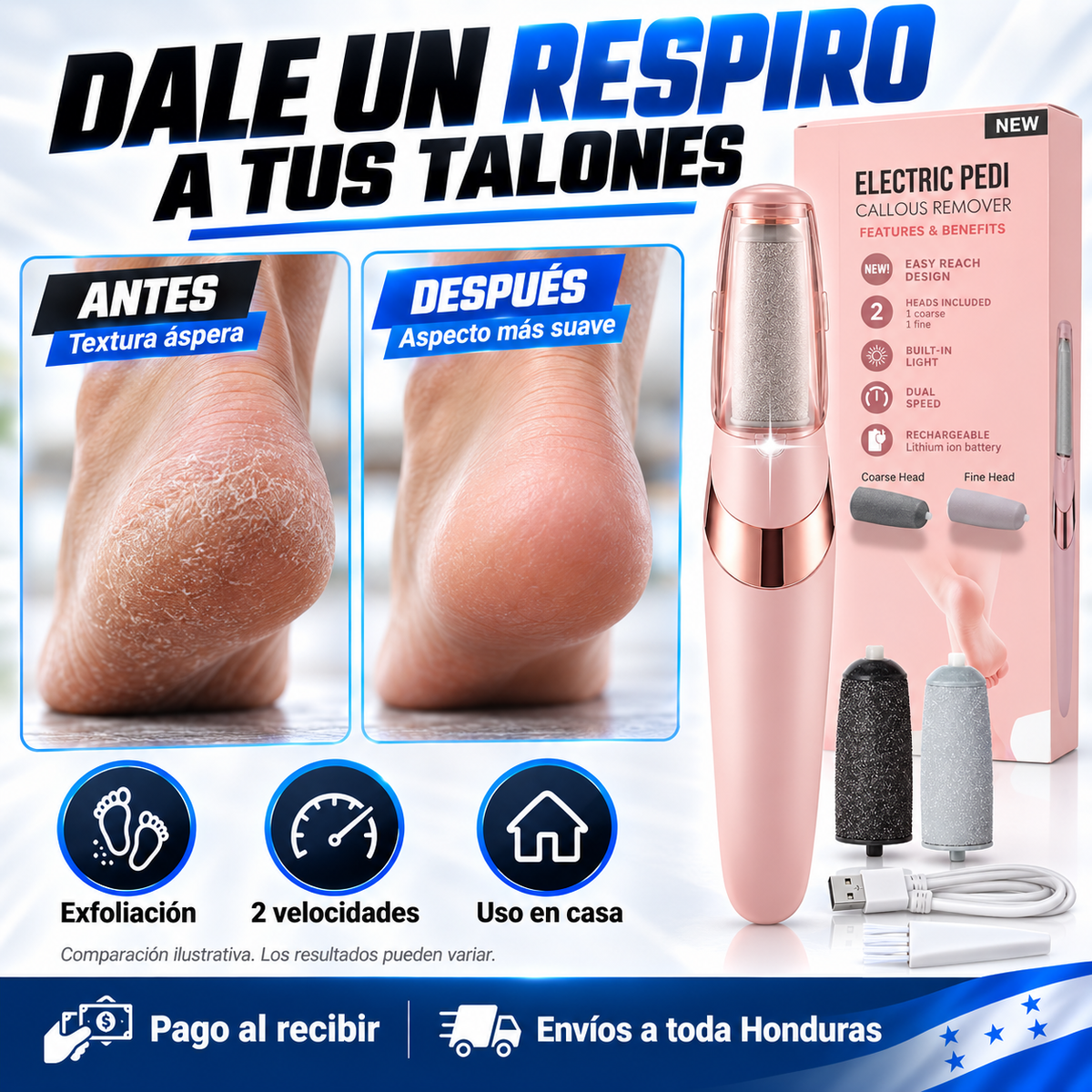 Removedor Eléctrico de Callos — ¡Pedicura Profesional en Casa sin Salón!