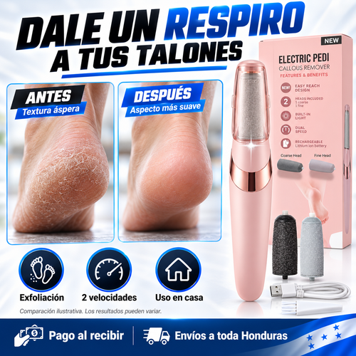Removedor Eléctrico de Callos — ¡Pedicura Profesional en Casa sin Salón!
